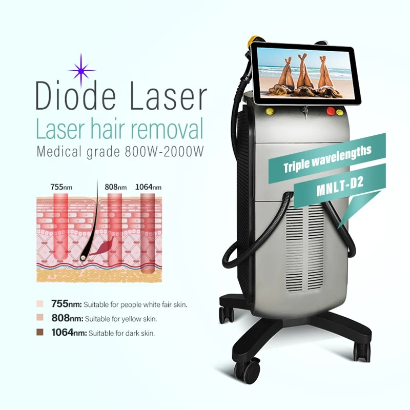 Alma Laser Soprano With AI Smart Handle Upgrade: Next-Gen Precision For Permanent Hair Removal