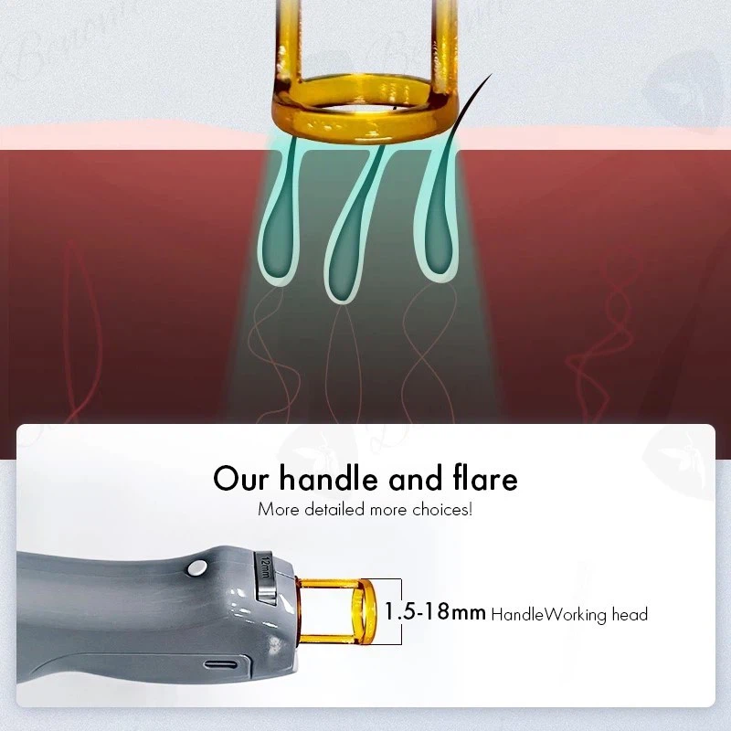 Candela Hair Removal Machine factory