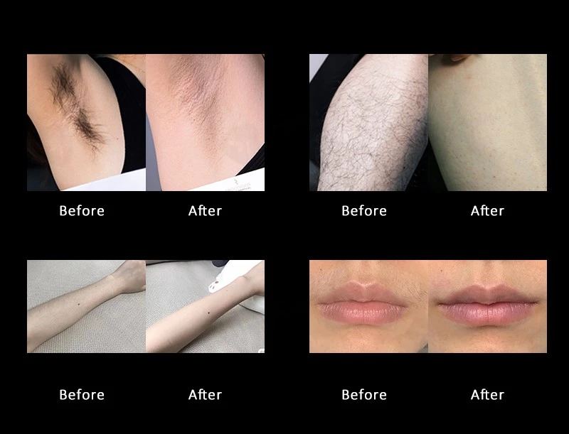 Effect comparisons