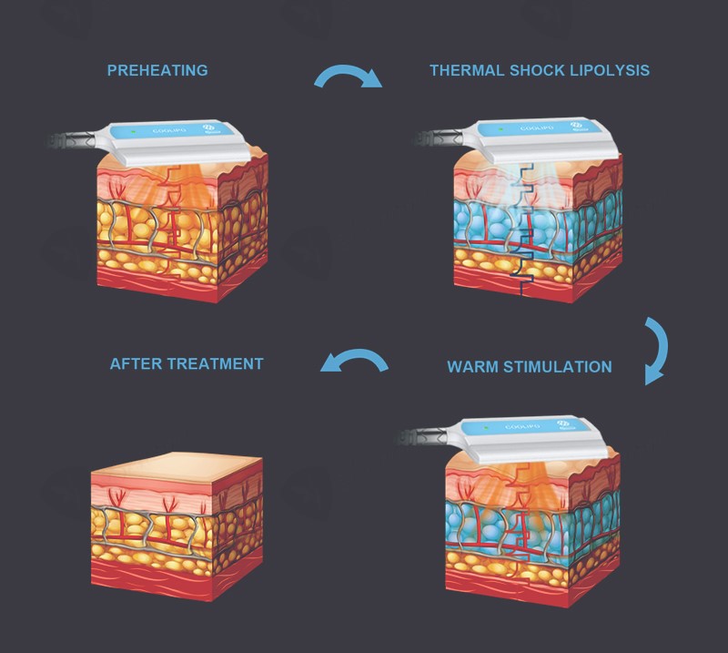 benomi--04 benomi--04